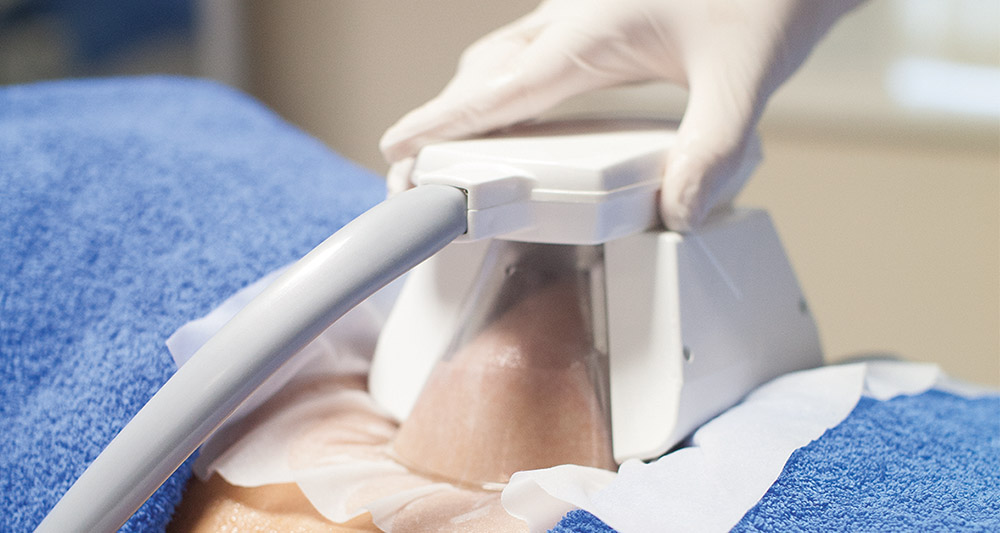 How Fat Freezing and HIFU Work Together? 2 Multiple Areas in One Session HIFU and Fat Freezing Hampshire