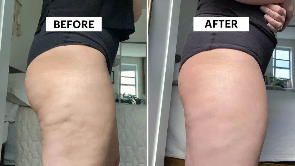 Do Toning Exercise Hampshire Really Tackle Cellulite?
